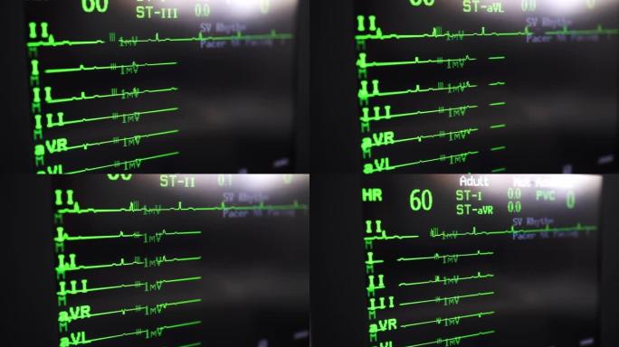 心电监护仪心电图心率医疗医院仪器