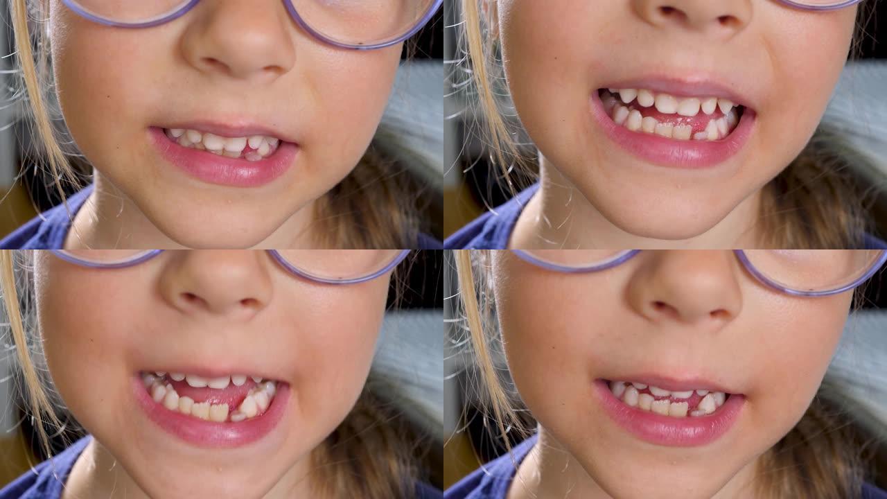小女孩微笑着露出第一颗沃比牙齿