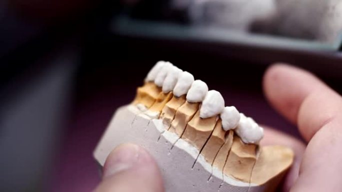 牙科技师的特写镜头在植入物实验室的工作场所的牙齿假体上绘制白色陶瓷釉