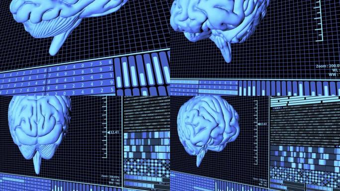 3D渲染解剖大脑旋转在未来的大脑分析技术HUD概念包括许多蓝色的数字元素。FUI。(相机平移)