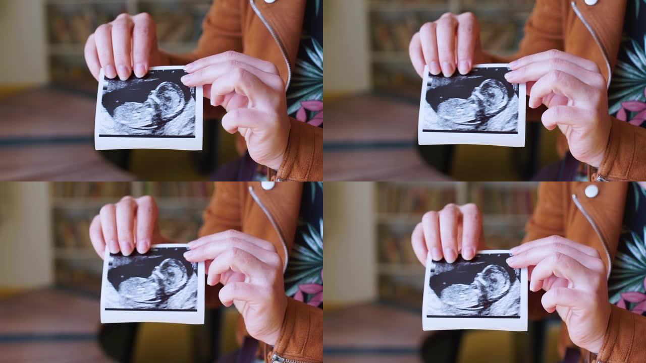 子宫内婴儿超声波扫描的特写照片。