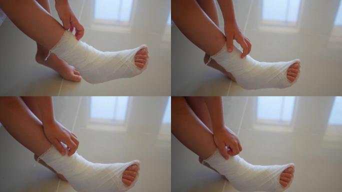 一个小女孩腿上有一个石膏。石膏痒得很厉害。用绷带包扎儿童的脚踝