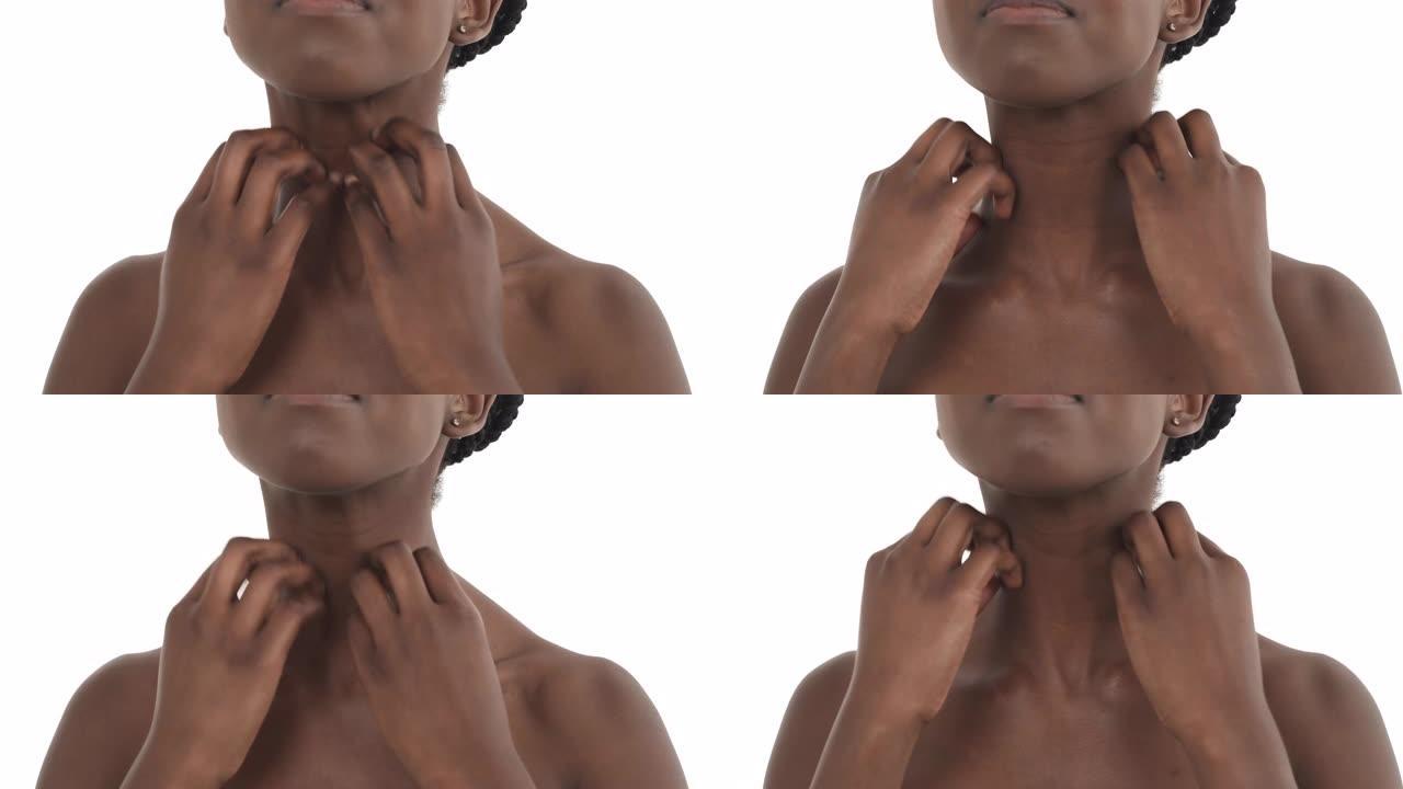 黑人女孩上半身的特写。女人抓挠和摩擦她发痒的脖子。皮肤刺激。孤立在白色背景上。皮肤问题概念。