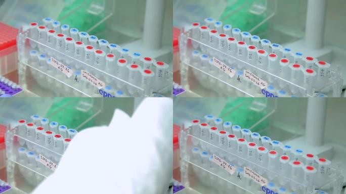 使用移液器在实验室中测试各种血液和DNA。戴丁腈手套的实验室中的DNA测试