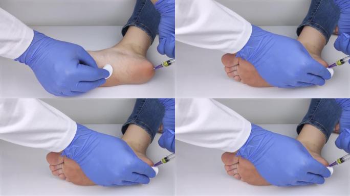 骨科医生在脚后跟中注射以减轻脚后跟骨刺引起的疼痛。医疗保健和非手术治疗的概念。