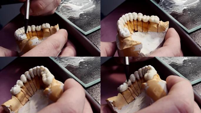 牙科技师的特写镜头在植入物实验室的工作场所的牙齿假体上绘制白色陶瓷釉