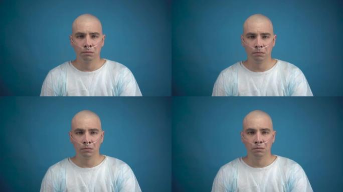 一个秃头的年轻男子带着肿瘤悲伤地看着蓝色背景上的相机。化疗导致脱发。