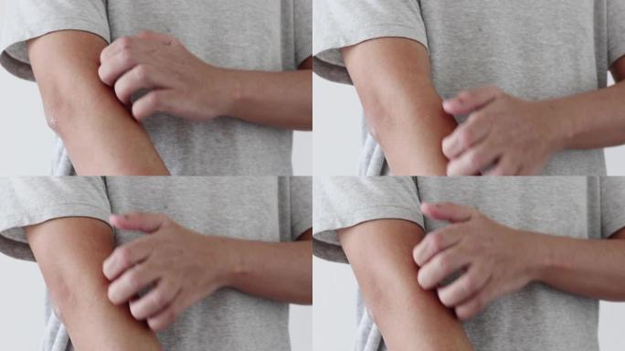年轻的亚洲男子因发痒的干性湿疹皮炎而瘙痒和抓挠手臂