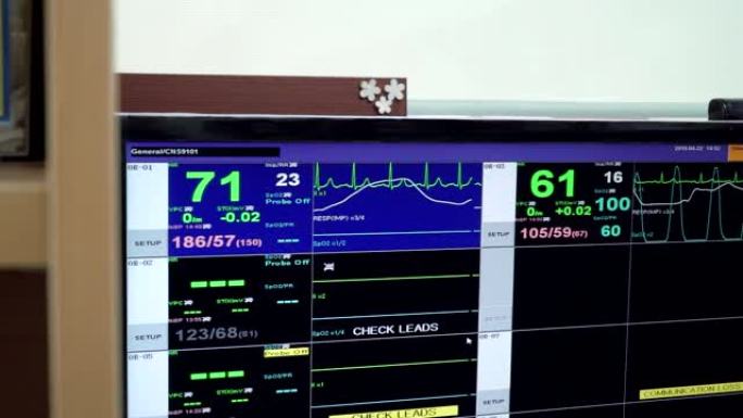 监视器显示带有患者生命指标的图表