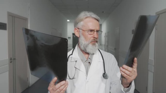 开朗的高级男医生在比较两次x射线扫描时对相机微笑