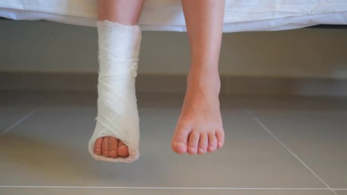 一个小女孩腿上有一个石膏。用绷带包扎儿童的脚踝
