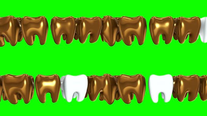 一排金牙中的白牙。3D渲染。牙科，出众，经营理念。
