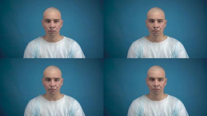 一个秃头的年轻男子带着肿瘤悲伤地看着蓝色背景上的相机。化疗导致脱发。