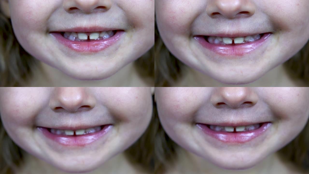一个两岁的小女孩露出牙齿。特写