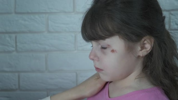 被殴打的孩子的脸。