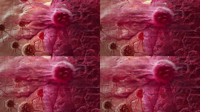 破坏和分解的癌细胞的动画