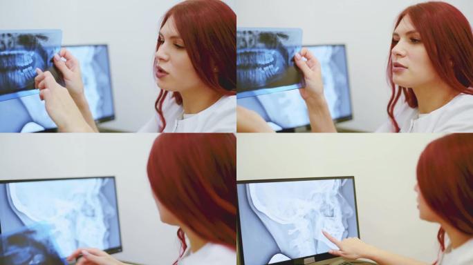 医生正畸医生分析患者颌骨的正射断层造影诊断