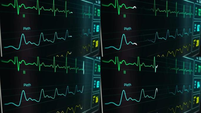 心电心率监测仪在医院中的应用