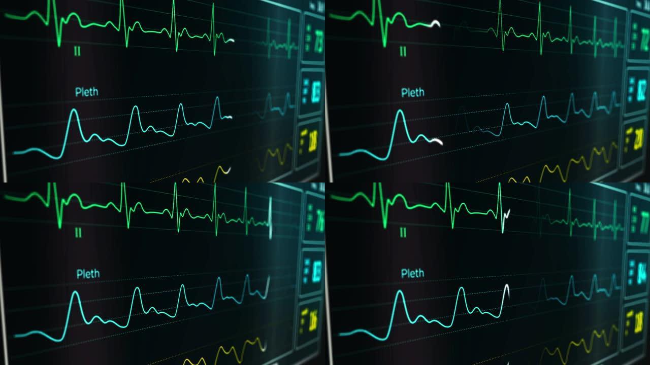 心电心率监测仪在医院中的应用