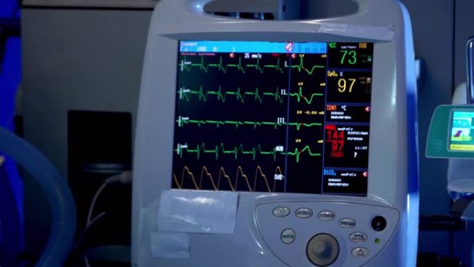 手术室手术期间的心脏监护仪