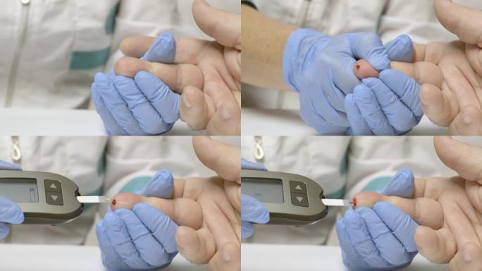 女医生使用血糖仪测量男性的血糖水平。