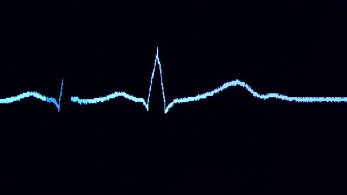 心电图波来自心率波浪图ICU生病