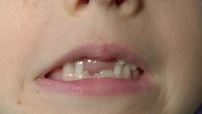 一个小男孩的微距镜头，显示他的嘴巴缺少乳牙。儿童牙齿变化的概念