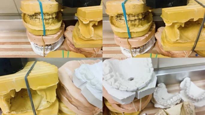 假牙模型木材石膏。牙科