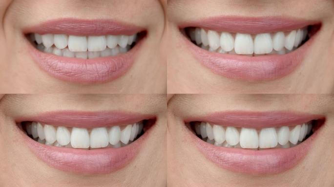 一个有着完美洁白牙齿的迷人女孩的微笑特写。完美的洁白牙齿和微笑。