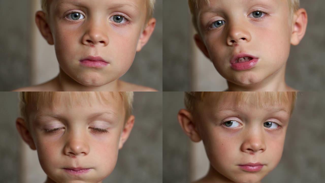 一个鼻子被划伤的小男孩的特写脸。
