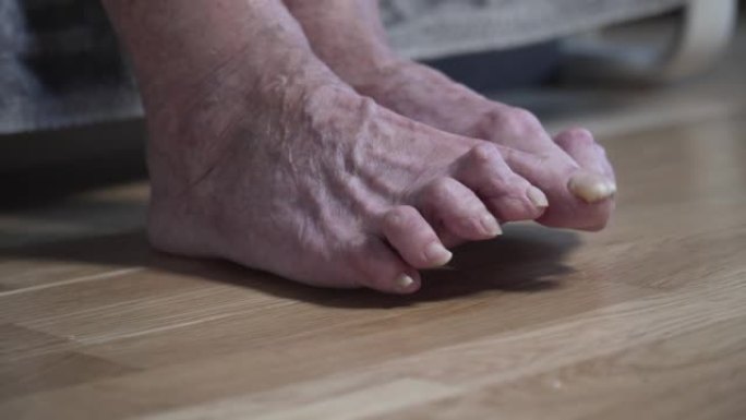 脚趾甲疼痛特写无法辨认的人，老人。一个可怜的女人的人脚长着未割的长指甲，看起来很恐怖。皱纹斑点腿高级