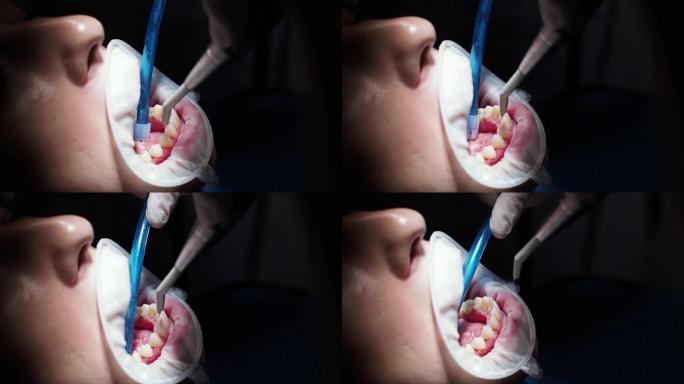 正畸医生的年轻女牙医招待会更换牙套抛光凝胶粘合