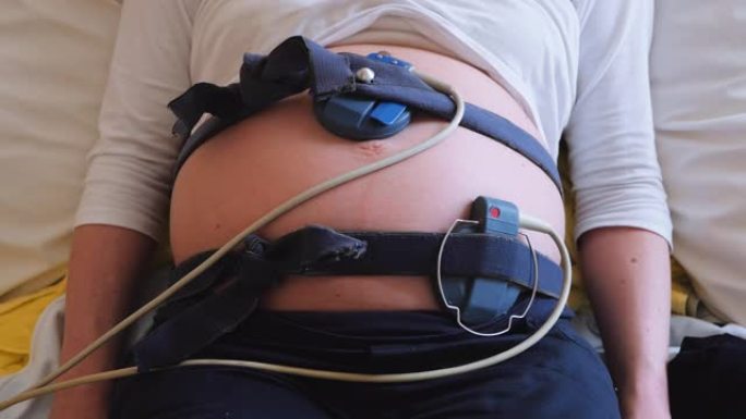 孕妇腹部上的胎儿监控带