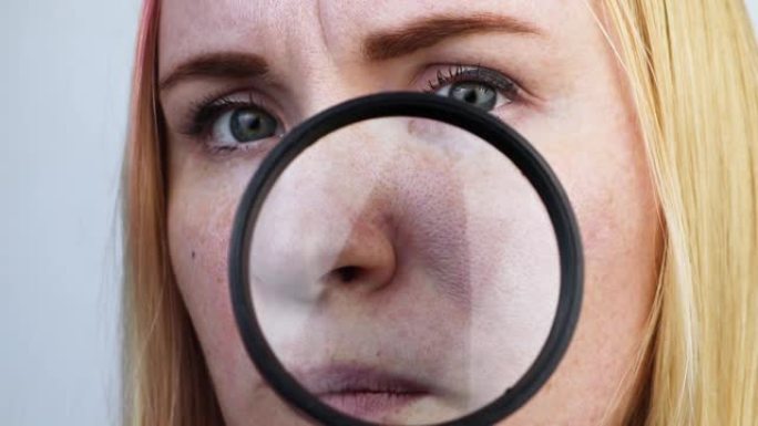 扩大的酒渣鼻，毛孔，黑斑，痤疮特写在鼻子。一名妇女正在接受医生检查。皮肤科医生通过放大镜，放大镜检查