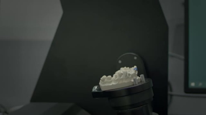 颌骨石膏的3D扫描。现代牙科技术。紫外线穿过牙齿