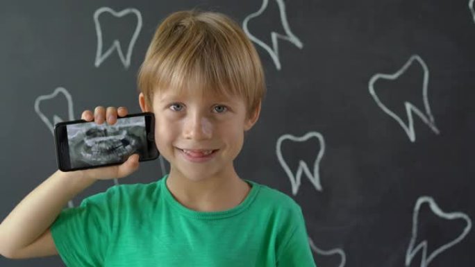 一个缺少乳牙的小男孩的特写镜头显示了他的x光牙齿照片。儿童牙齿改变的概念