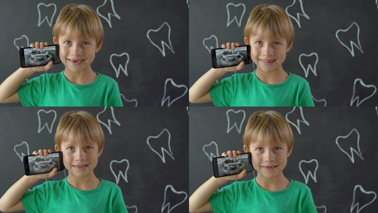一个缺少乳牙的小男孩的特写镜头显示了他的x光牙齿照片。儿童牙齿改变的概念