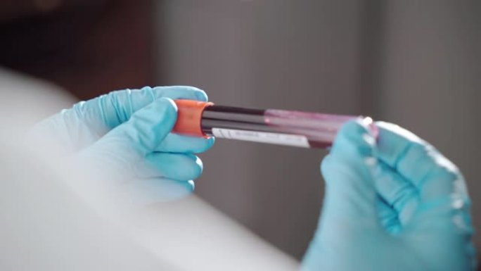 血液试管在医生的手中新型冠状病毒肺炎阳性结果，微生物学手在保护手套上的特写冠状病毒感染者的血管。实验