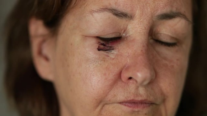 年长的女人擦伤，伤痕累累的脸的特写镜头