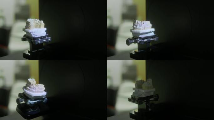 颌骨石膏的3D扫描。现代牙科技术。紫外线穿过牙齿