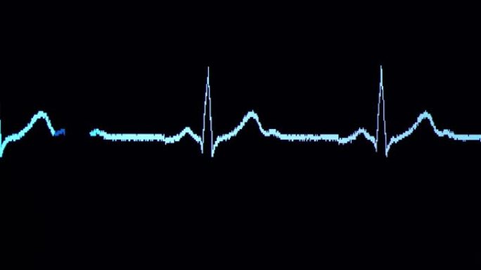 心电图波来自心电图心动心跳
