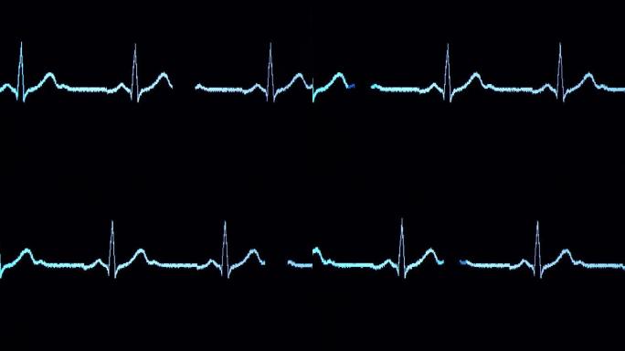 心电图波来自心电图心动心跳