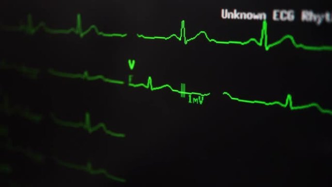 心电图波心电图心率医疗医院仪器