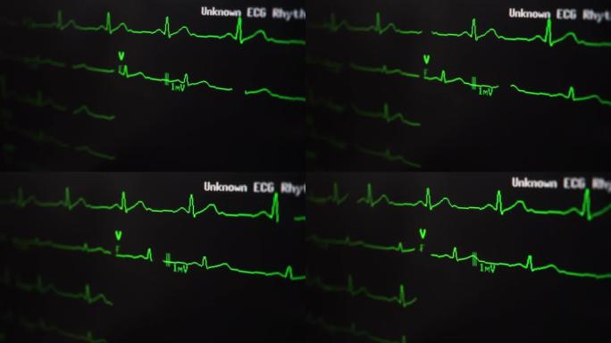心电图波心电图心率医疗医院仪器