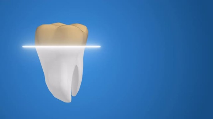 旋转孤立3D牙齿的美白治疗过程概念。4k动画。