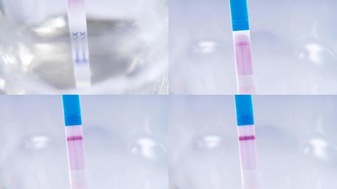 单条妊娠试验阴性。进行实验室测试。