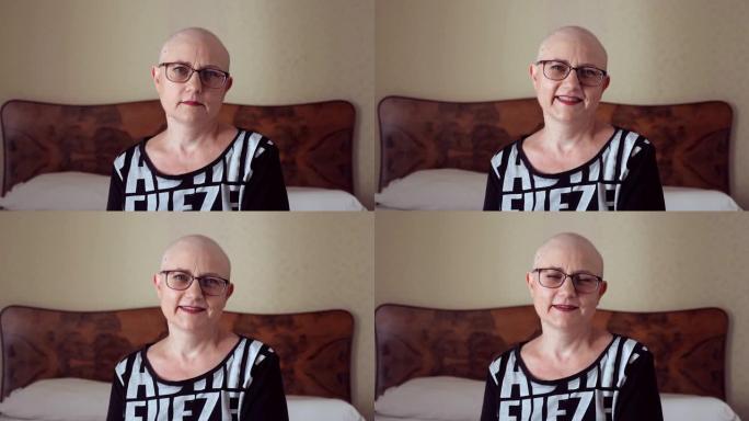 接受化疗后的成熟秃头女人看着镜头微笑