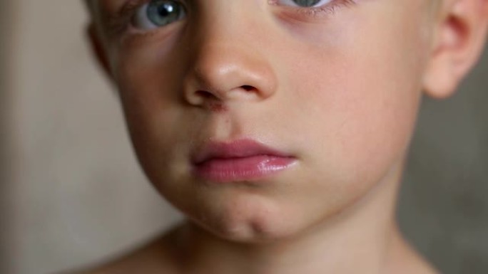 一个鼻子被划伤的小男孩的特写脸。一个男孩脸上的伤口
