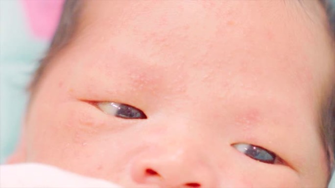 新生婴儿特写眼睛