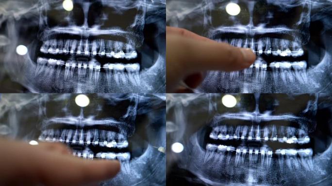 电脑显示器和医生或牙医手上的牙齿x光
